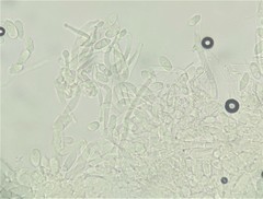 Hypomyces