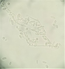 Hypomyces