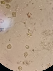 Tetradesmus lagerheimii