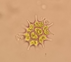 Pseudopediastrum boryanum longicorne