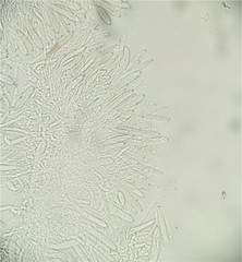 Pezizomycotina