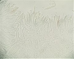 Pezizomycotina