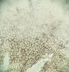 Pezizomycotina