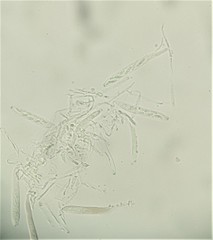 Pezizomycotina