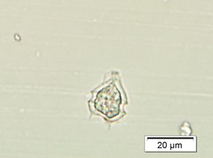 Protoperidinium bipes