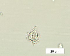 Protoperidinium bipes
