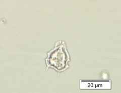 Protoperidinium bipes