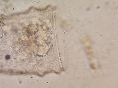 Ptychocylis acuta