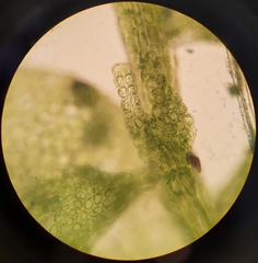 Siphonolejeunea nudipes