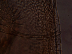 Simocephalus exspinosus