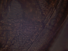 Simocephalus exspinosus