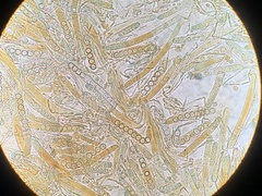 Plicaria endocarpoides