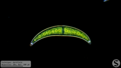 Closterium moniliferum