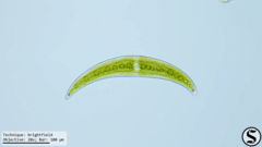 Closterium moniliferum