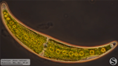 Closterium moniliferum