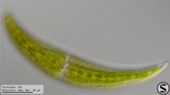 Closterium moniliferum