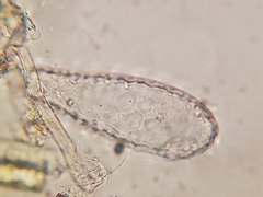 Euglypha