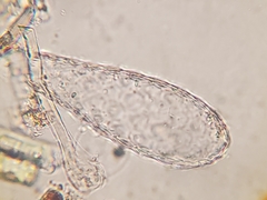 Euglypha