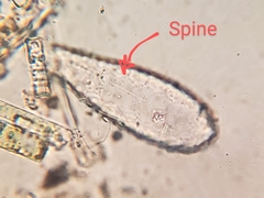 Euglypha