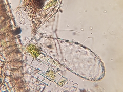 Euglypha