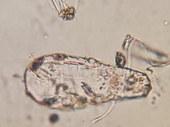 Quadrulella symmetrica