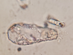 Quadrulella symmetrica