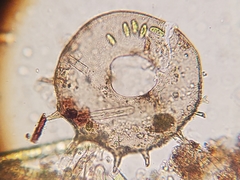 Centropyxis discoides