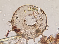 Centropyxis discoides