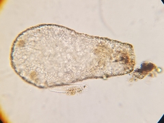 Hyalospheniidae