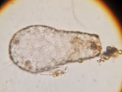 Hyalospheniidae
