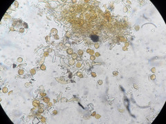 Botryobasidium simile