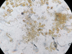 Botryobasidium simile