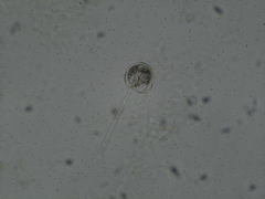 Vorticella campanula