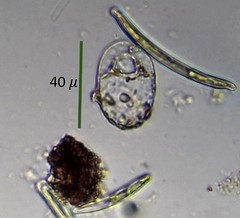 Trinema complanatum