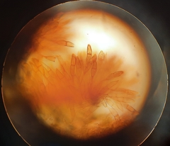 Puccinia graminis