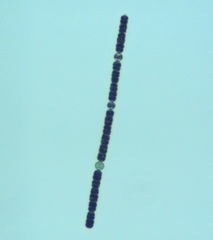 Dolichospermum