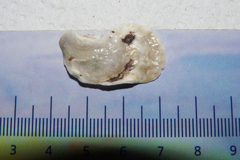 Bivalvia