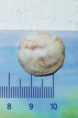Crepipatella dilatata