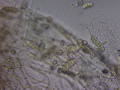 Dacrymyces variisporus