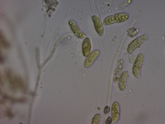 Dacrymyces variisporus