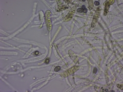 Dacrymyces variisporus