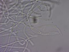 Dacrymyces variisporus