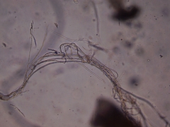 Lecanicillium saksenae