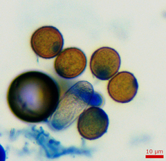 Uromyces anthyllidis