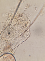 Kellicottia longispina