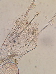 Kellicottia longispina