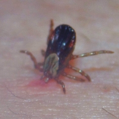 Dermacentor andersoni