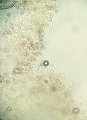 Coprinopsis cineraria