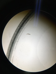 Symphyla