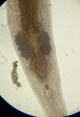Macrostomum